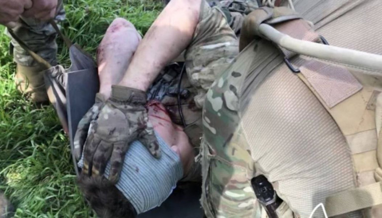 Американский наёмник, раненый во время боёв за Орехово